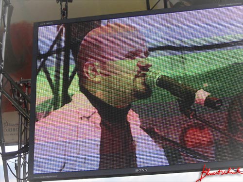 wow - so grossssss!!!